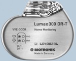 LexosDRT