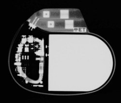 PhilosII XRay