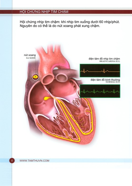 p04