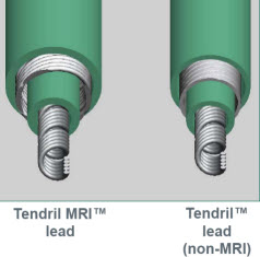 Tendril MRI
