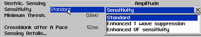 Select Sense