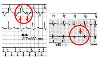 TWave Before and After